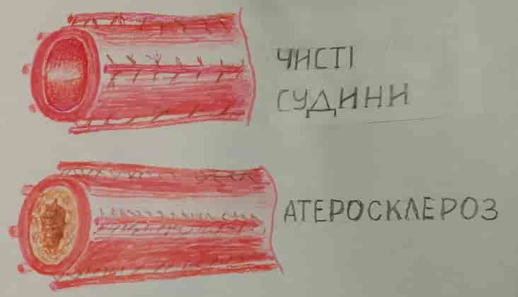 Фото: судини